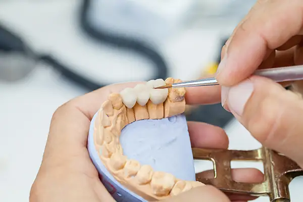 A dental professional working on dental bridge placed on top of a model of a mouth